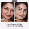 Undereye Concealer Power Kit